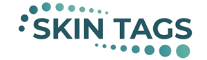Acne TreatmentLogo